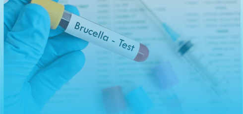 Brucella test
