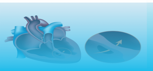 Illustration maladies congénitales